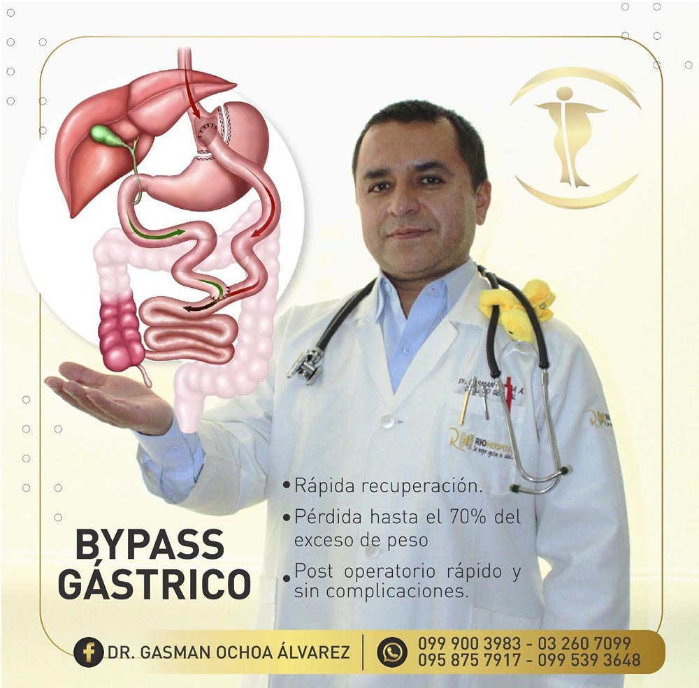 bypass gastrico riobamba