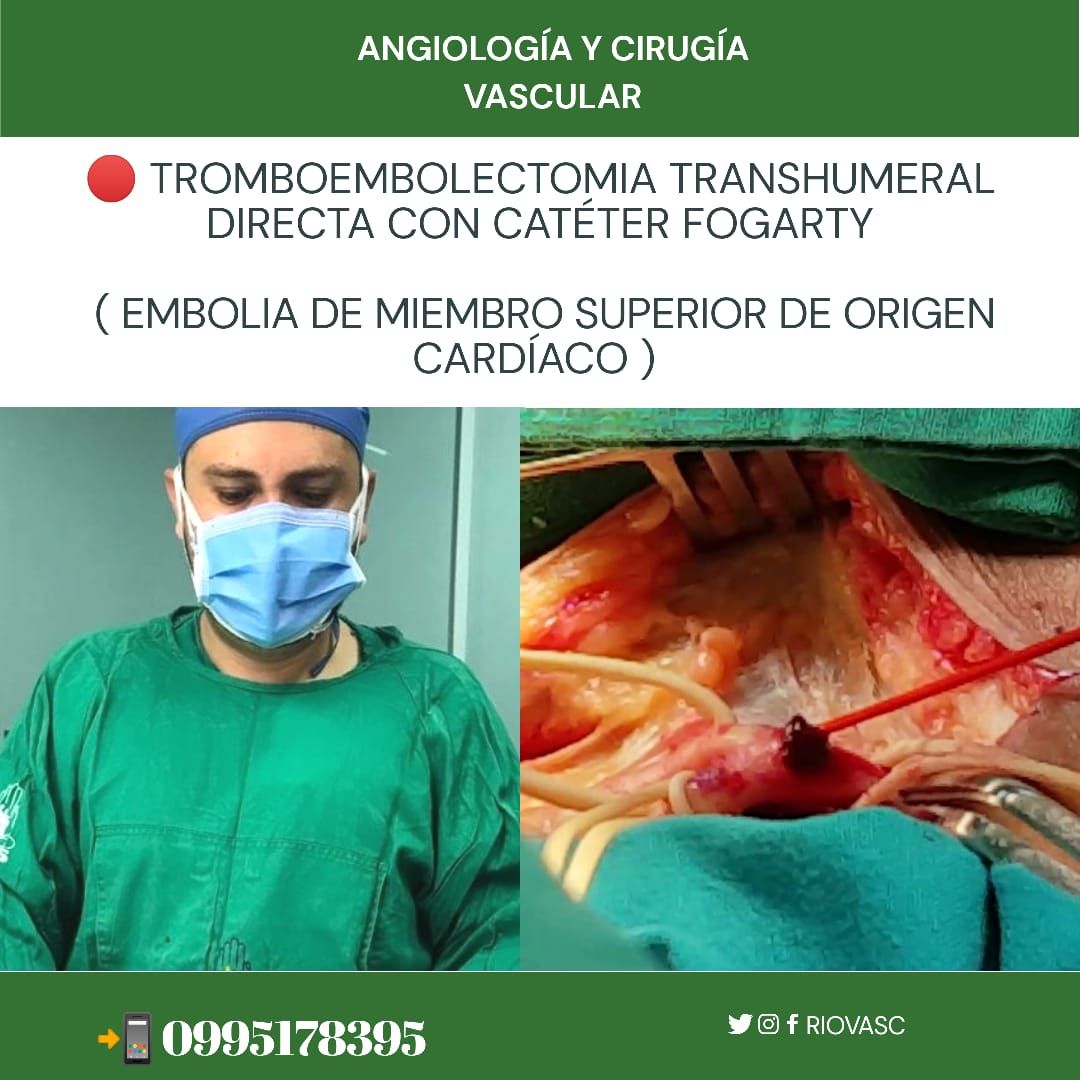 ANGIOLOGÍA Y CIRUGUA VASCULAR