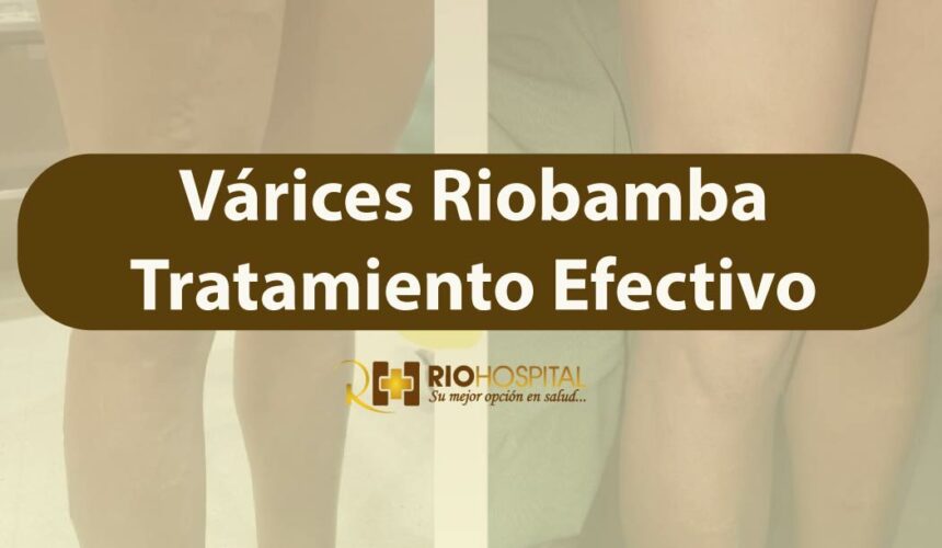 varices riobamba