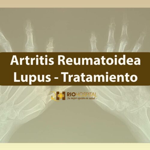 artritis riobamba