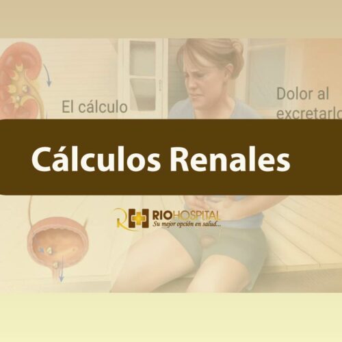 calculos renales