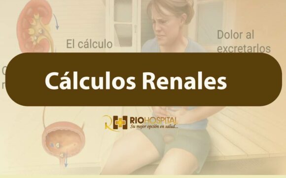 calculos renales