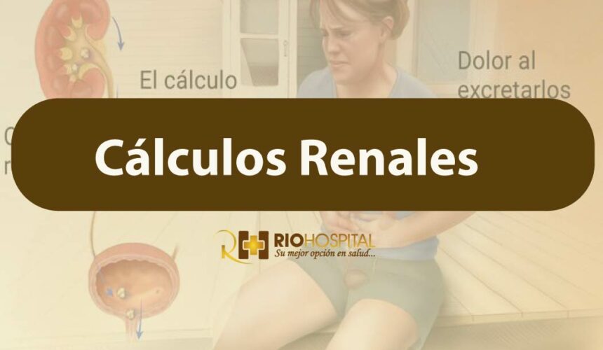 calculos renales