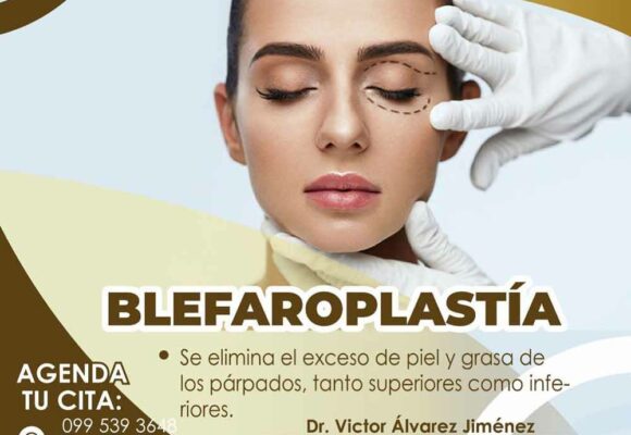 blefaroplastia riobamba