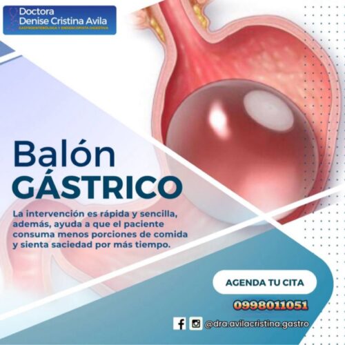 balon gastrico