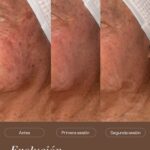 dermatologo riobamba