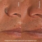 dermatologo riobamba