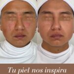 dermatologo riobamba