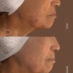 dermatologo riobamba